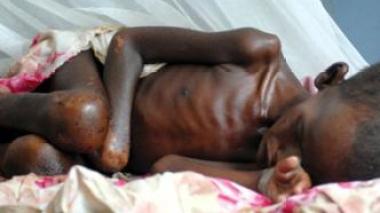 Corne de l'Afrique: la FAO tire à nouveau la sonnette d’alarme contre la famine