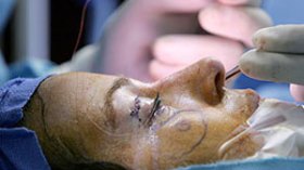 مراهقات يمهدن للعمليات التجميلية عن طريق »البورتريهات«