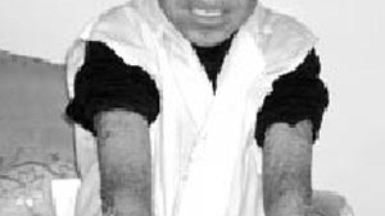 »جلد ثعبان« يكسو فاتح منذ 9 سنوات