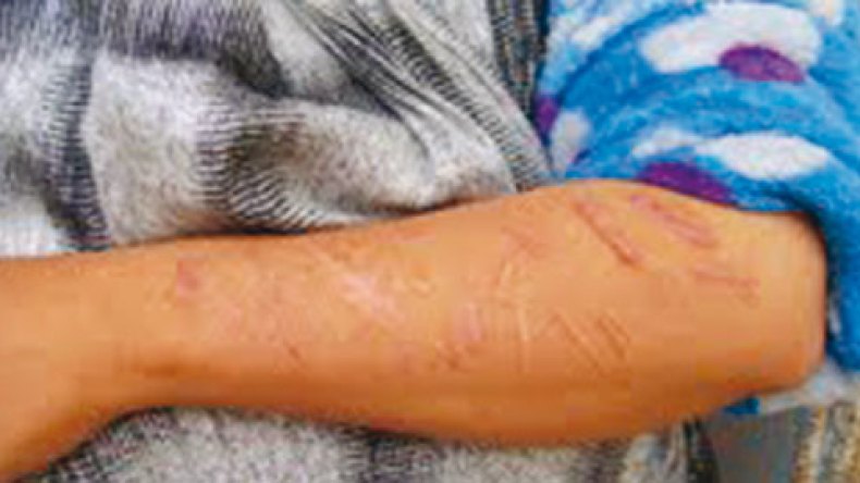 والدي دمرني وخالي أغرقني في  عالم الدعارة