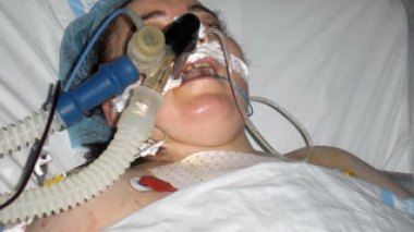 Algeria counts 10 million patients; half of them do not leave hospitals