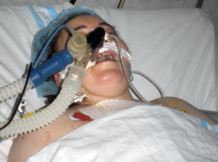 Algeria counts 10 million patients; half of them do not leave hospitals