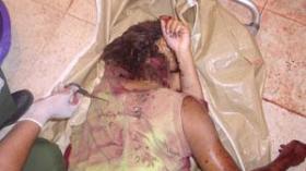 زوج من خنشلة يذبح زوجته وينتحر بمبيد الحشرات