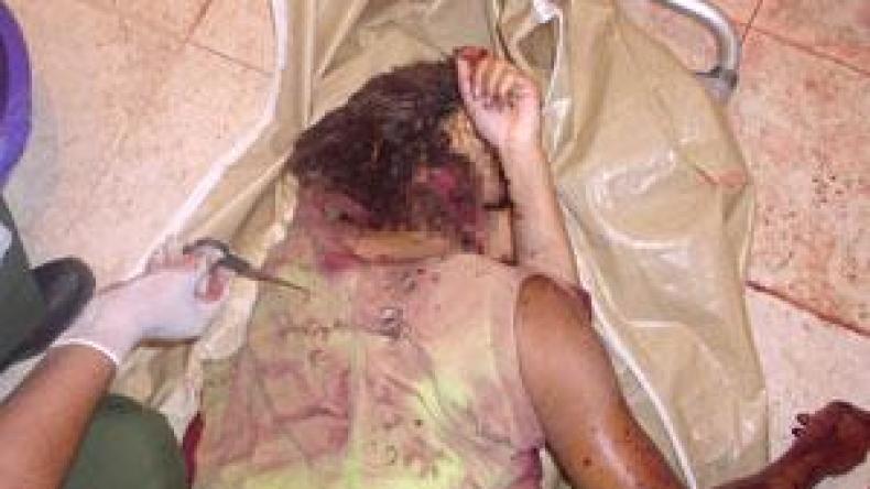 زوج من خنشلة يذبح زوجته وينتحر بمبيد الحشرات