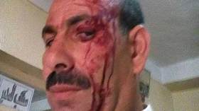 وليّ تلميذ “ينطح” مدير مدرسة في مكتبه بسبب الكتب!