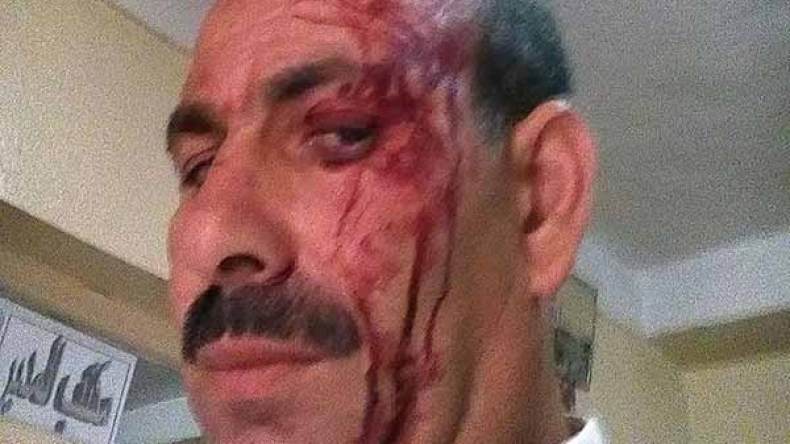 وليّ تلميذ “ينطح” مدير مدرسة في مكتبه بسبب الكتب!