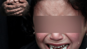 وحش بشري يعتدي على طفلة في الرابعة بالطارف