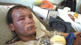 “شاهدت حروقا وأعراضا غريبة على الجرحى لم أر مثلها في حياتي”