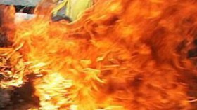 فتاة في العشرين تحرق والدها مرتين بالزيت المغلى في عين تموشنت