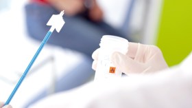 مسحة عنق الرحم خطوة تجنبك أمراض الرحم