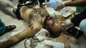 “سرطانات قاتلة تهدد سكان غزة جراء استخدام الأسلحة المحظورة”