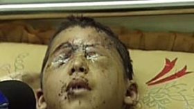 الصهاينة يقصفون غزة بقنابل مسرطنة ومسببة للعقم