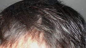 “جال” يحصد الشعر ومساحيق تخرب الوجه وصابون يحرق البشرة