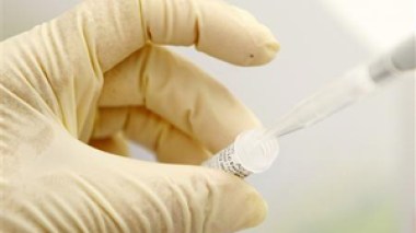 Grippe: l'OMS préconise de renforcer les contrôles sur les fermiers