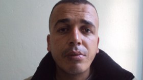 شاب يخيط فمه احتجاجا على ظروفه الاجتماعية القاسية