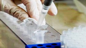 مفاوضات بين معهد باستور ومخبر “جي أس كا” لتجنيب الجزائر خسائر بـ 600 مليار