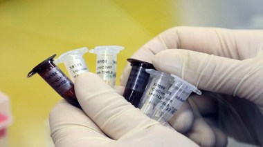 Algeria: Fears Of Resurgence Of “H1 N1” Influenza