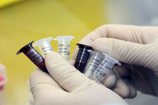 Algeria: Fears Of Resurgence Of “H1 N1” Influenza