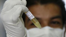 الجزائر تعلن الطوارئ الحمراء لمواجهة أنفلونزا الخنازير