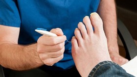 بتر عشوائي لـ 8 آلاف قدم سكري سنويا