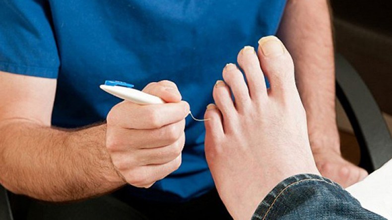 بتر عشوائي لـ 8 آلاف قدم سكري سنويا