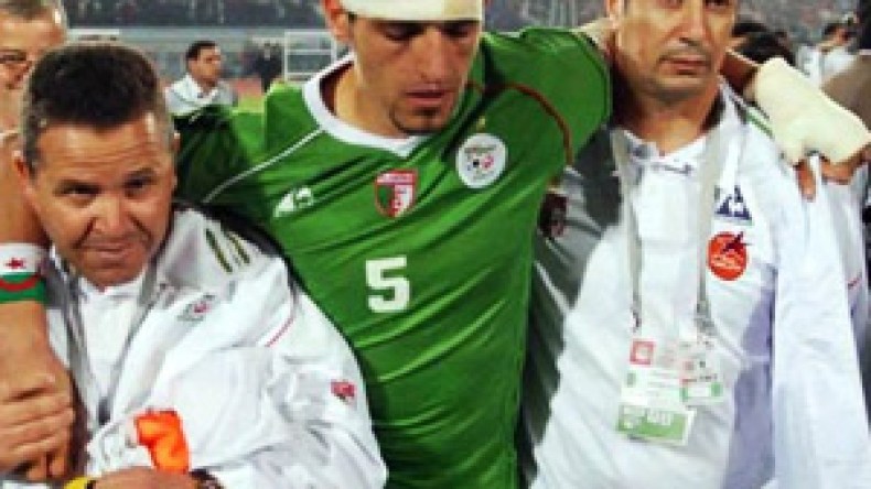 “حليش” معصوب الرأس أحلى من “دي كابريو”