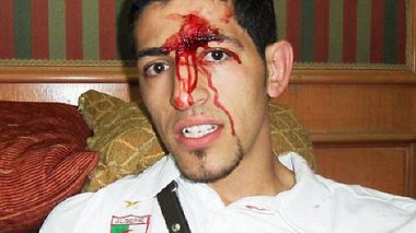 Premier League stars caught in coach ambush: FIFA concern after two players injured