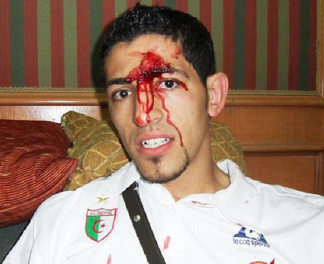 Premier League stars caught in coach ambush: FIFA concern after two players injured