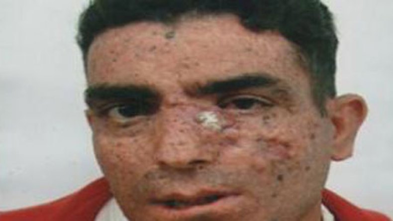 نقل عندليب الأغنية الشاوية نمر حسان إلى مستشفى باريس