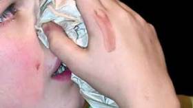 دراسة: الحساسية تهاجم الأطفال خلال النوم أيضا