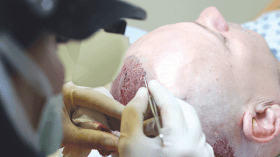 جزائريون يزرعون الحواجب واللحية والشوارب!