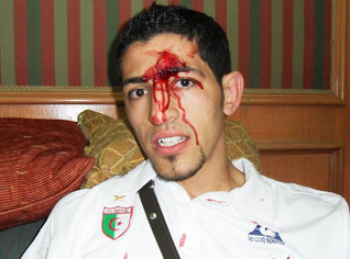 Fifaâ€™s verdict against Egypt : Much ado about nothing