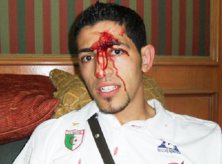 Rafik Helliche to Echourok:  We lived a Hitchcock- like scenario in a minute