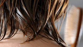 ابتعدي عن تبليل شعرك بالماء والتعرض لأشعة الشمس