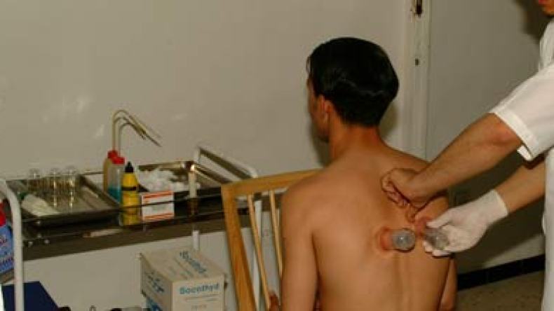 سبعون بالمئة من مستعملي الحجامة مهدّدون بالسيدا