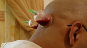 بوضياف يعلن الحرب على محلات الحجامة والرقية