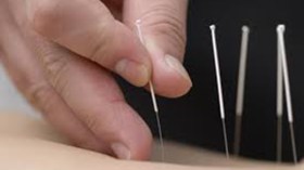 المتعالجون بالإبر الصينية يطالبون بإجراء التحاليل في مخابر المستشفى