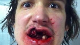 لاعب أمريكي للهوكي على الجليد يتعرّض لـ “إعتداء متوحّش”!