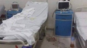 متى نعالِج وفق مقاييس عالمية؟