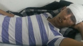 الصحراء الغربية: تنديد واسع بالاعتداء المغربي الوحشي على الشاب أحمد الحواصي
