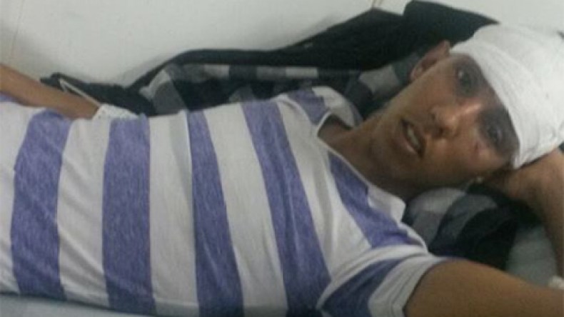 الصحراء الغربية: تنديد واسع بالاعتداء المغربي الوحشي على الشاب أحمد الحواصي