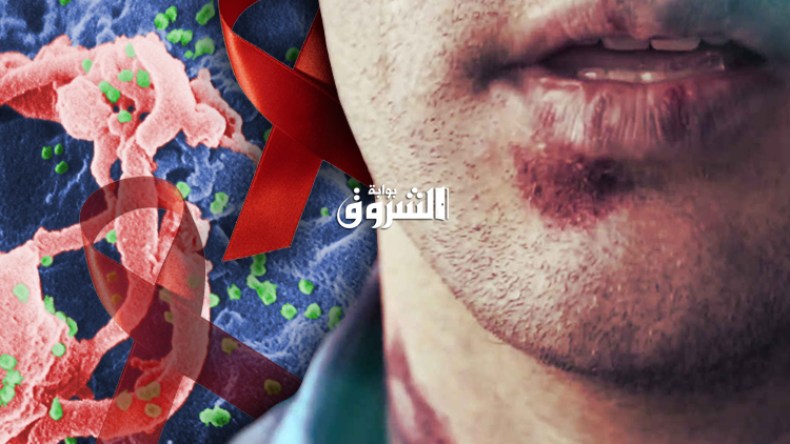 12 ألف جزائري مُصاب بالسيدا و800 مريض سنويا!