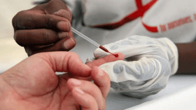 اكتشاف 9 حالات سيدا بالجلفة