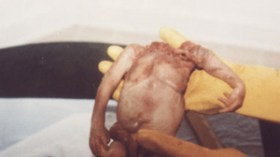 عاملة نظافة بالمستشفى تقود شبكة إجهاض للعازبات باستعمال أدوية نادرة بوهران