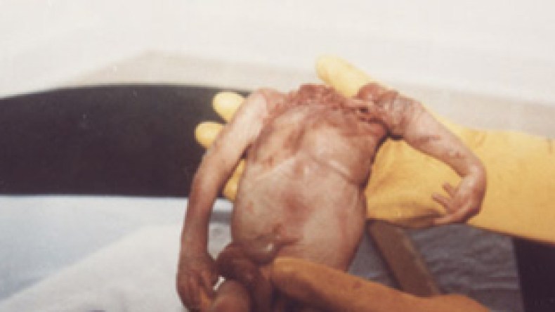 عاملة نظافة بالمستشفى تقود شبكة إجهاض للعازبات باستعمال أدوية نادرة بوهران