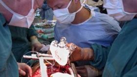 زرع الأعضاء البشرية تثير فتنة مرة أخرى بالعالم الإسلامي