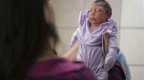 زيكا ونساء أمريكا.. ولادة 4 آلاف طفل برأس صغير!