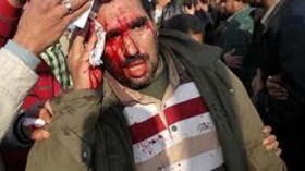 Yémen: des dizaines de blessés dans des heurts entre pro et anti-élection