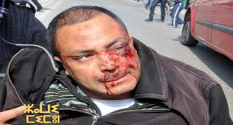 Maroc: HRW dénonce l'impunité policière après une agression contre l'un de ses  membres