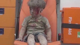 وفاة شقيق الطفل عمران بعد إصابته في القصف